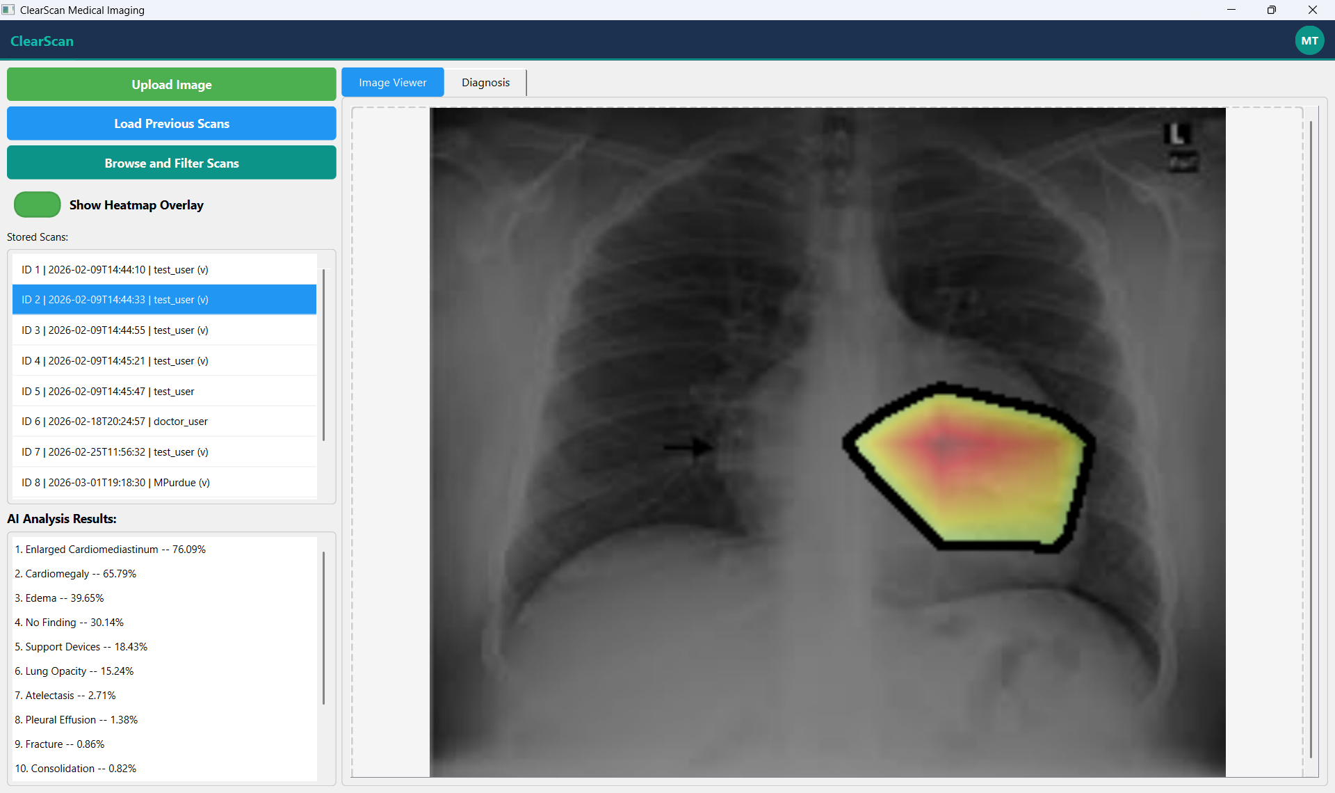 X-ray upload interface and heatmap detection